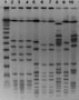 Final analysis of bacterial strains of S. aureus