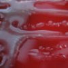 Growth of the mucosal strain P. aeruginosa on blood agar