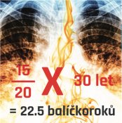 Diagnóza: Chronická obstrukční plicní nemoc (CHOPN) a program časného záchytu v rizikové populaci