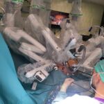 robotická operace srdce