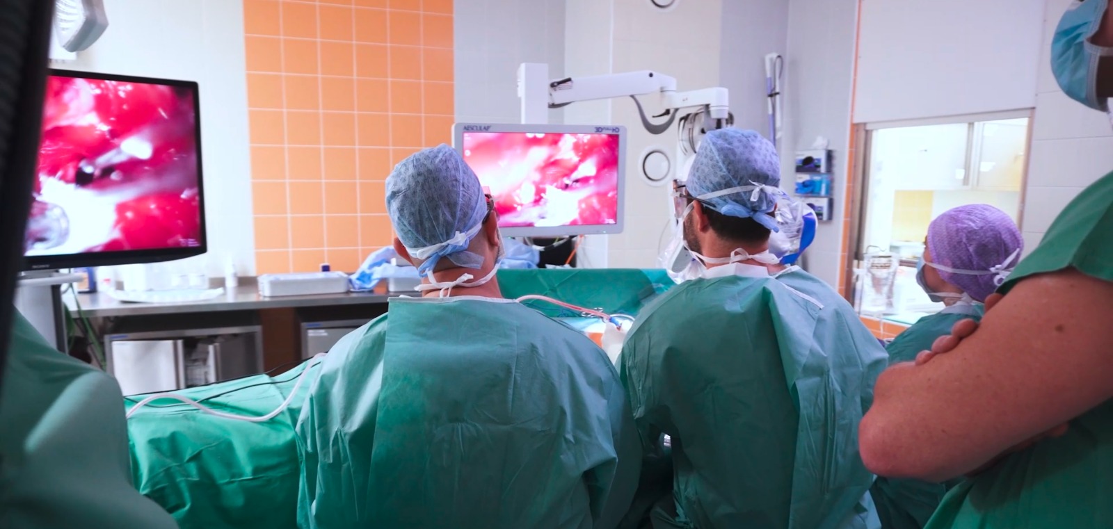 vestibulární schwannomy