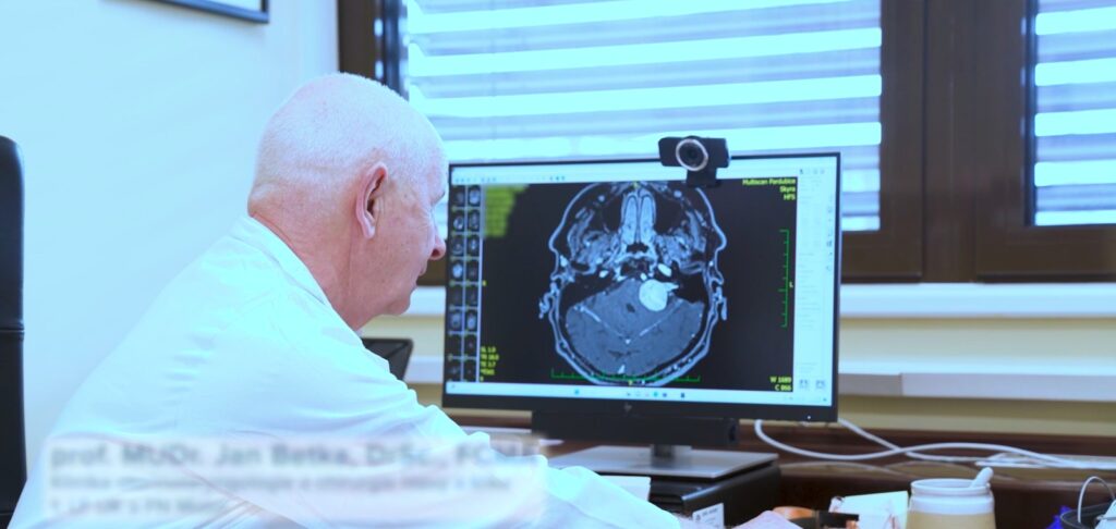 vestibulární schwannomy