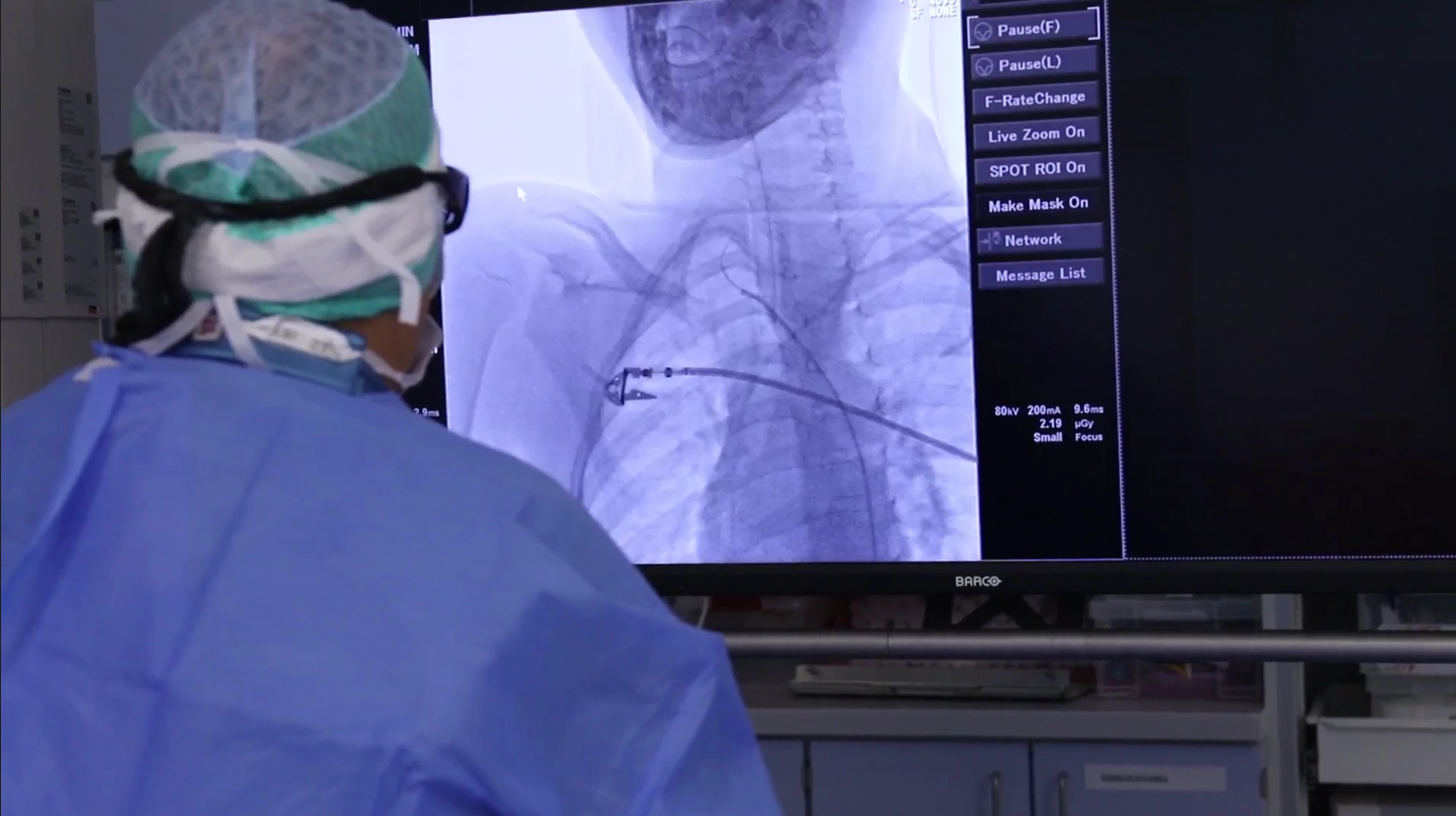 Radiologové z FNMH stojí v čele diagnostiky i léčby vzácného cévního onemocnění. Podílí se i na vzniku specializovaného centra