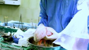 Transplantace plic - operační sál